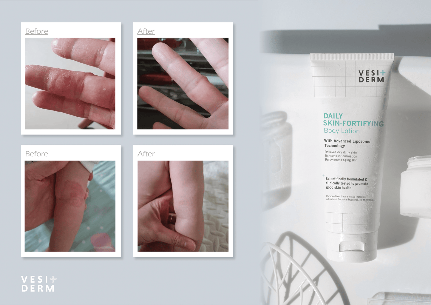 VESIDERM SKIN FORTIFYING Daily Body Lotion 200ml