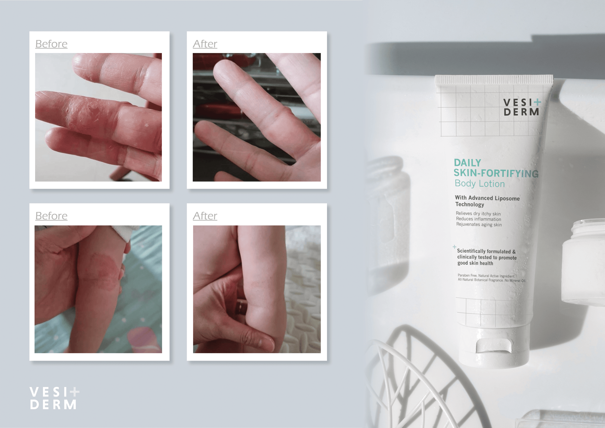 VESIDERM SKIN FORTIFYING Daily Body Lotion 200ml