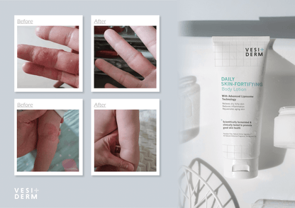 VESIDERM SKIN FORTIFYING Daily Body Lotion 200ml